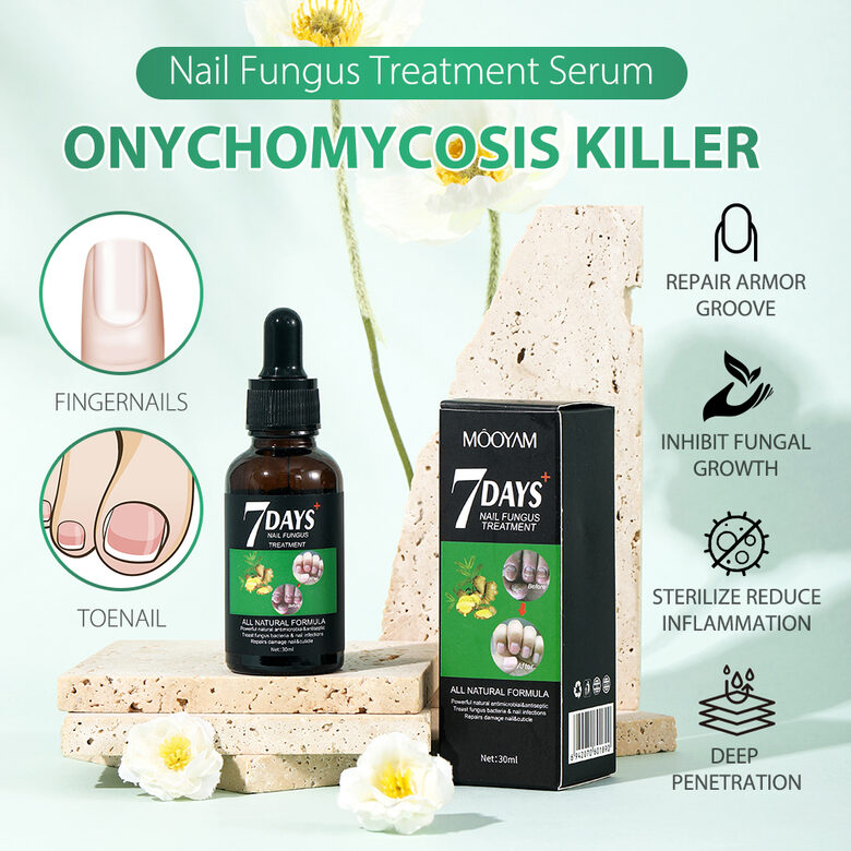7 DAYS Nail Fungus Treatment – Nagu sēnītes ārstēšana un kopšanas .